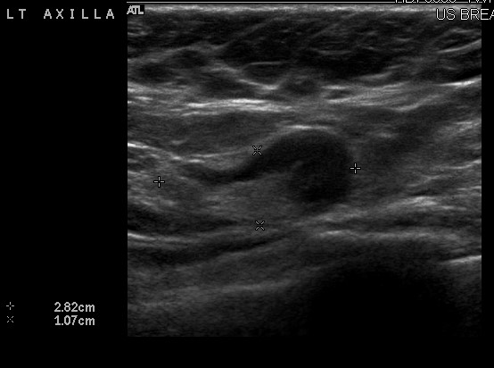 Figure 2 Ultrasound