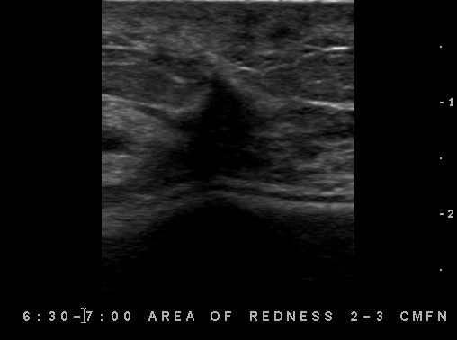 Figure 3 Ultrasound