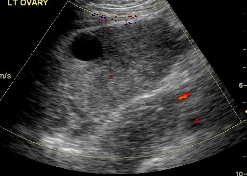 pelvic imaging exam houston