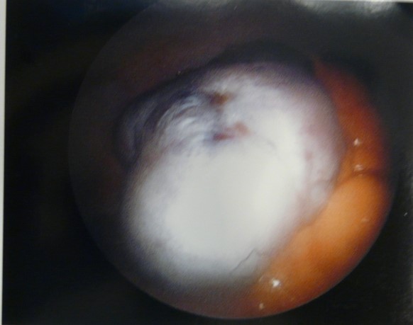 pelvic imaging houston
