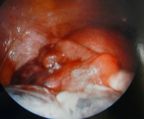 pelvic imaging of blood flow