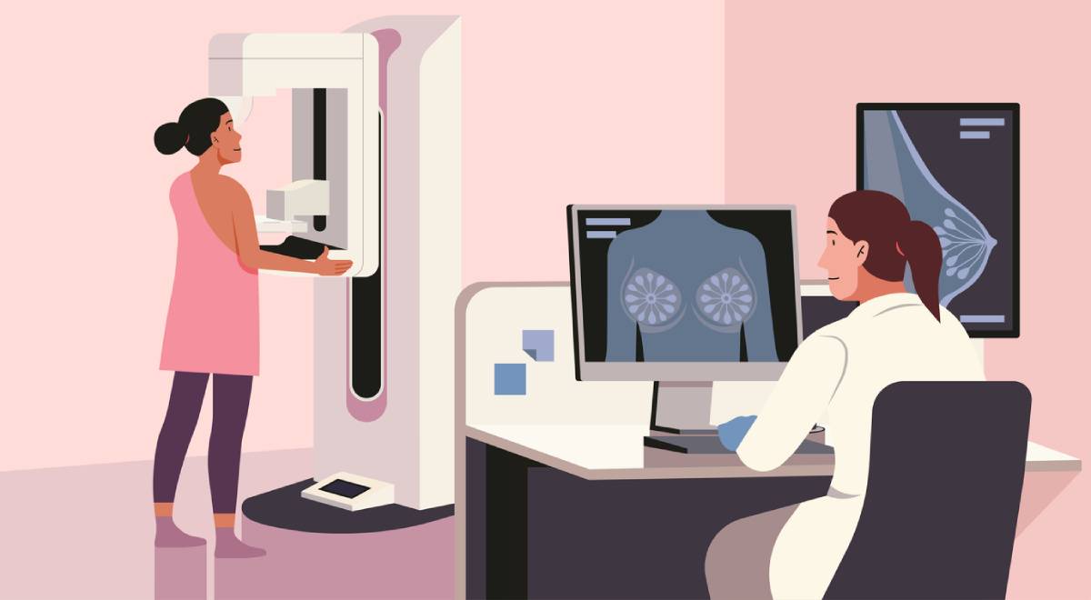featured image for how to prepare for a mammogram
