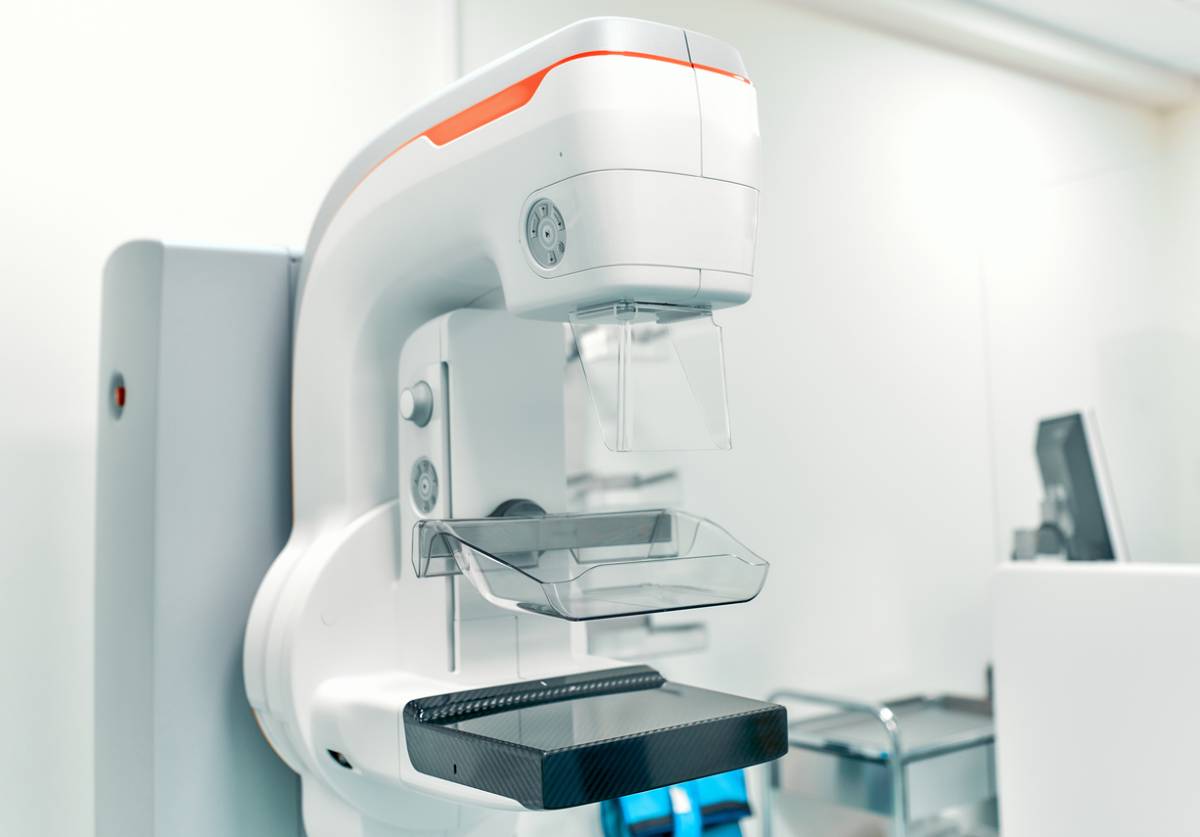 concept for machine with advantages of 3d mammography